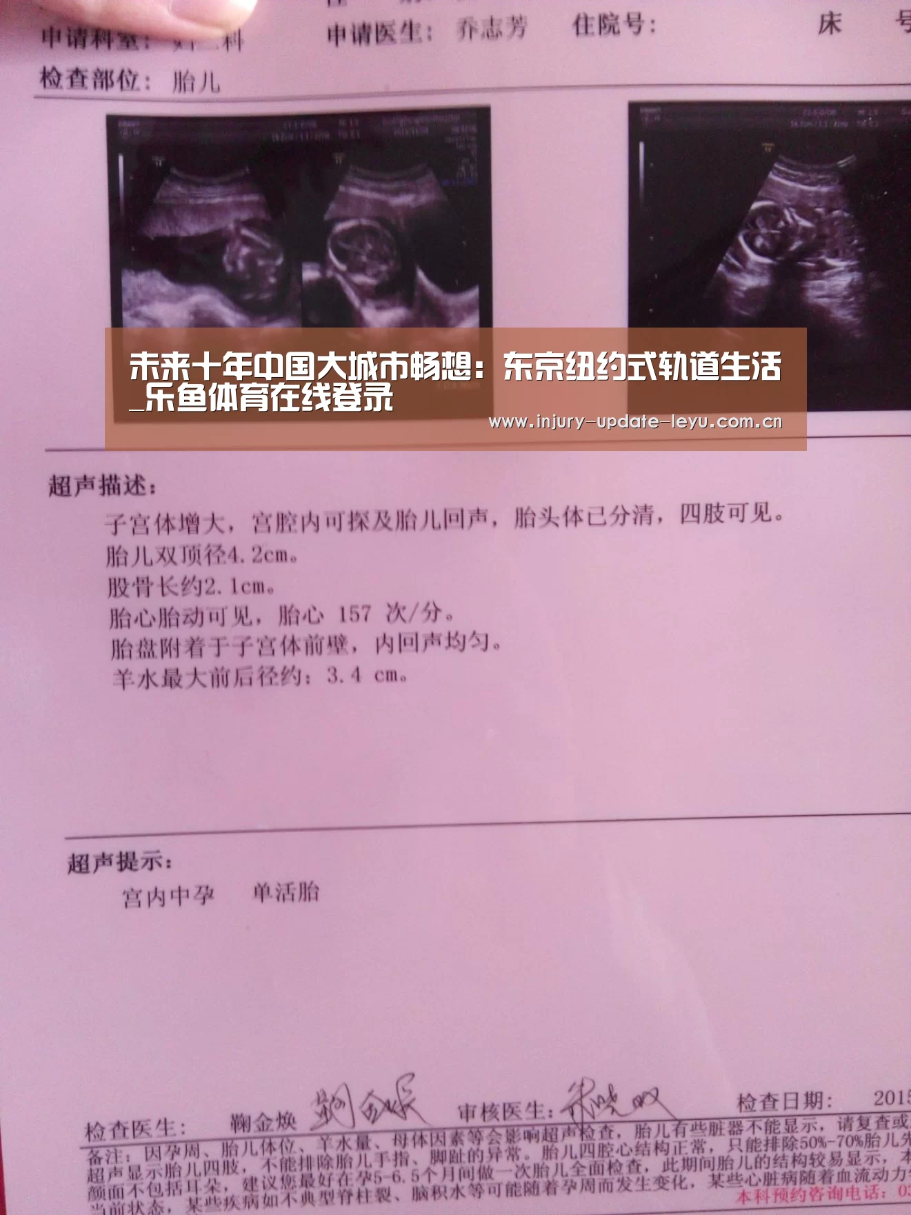 未来十年中国大城市畅想:东京纽约式轨道生活_乐鱼体育在线登录(图2) 乐鱼体育网站入口